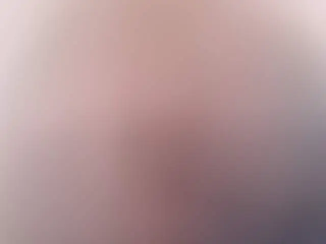 Cercatrice1 image 3